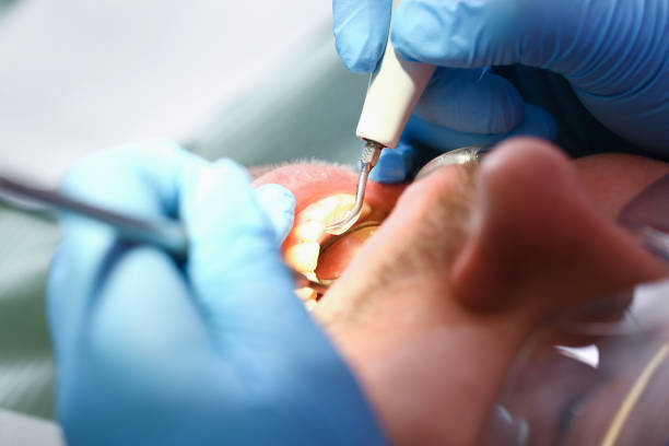 Best Emergency Care for Gum Disease in Gages Lake, IL